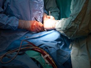 cirurgia cardíaca de lesão de tronco de coronária esquerda